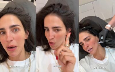 Bárabara de Regil desata reacciones tras inyectarse esperma de salmón