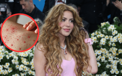 Alertan por posible exposición de sarampión en concierto de Shakira