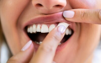 Ven en productos alternativos al cigarro una opción para reducir daños