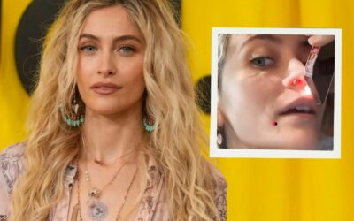 Paris Jackson revela que el consumo de drogas le ha perforado el tabique nasal