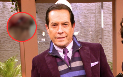 ¿Cuál es el estado de salud de Pepillo Origel tras accidente que le dejo herida en la cabeza?