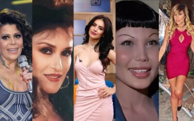 5 artistas que pusieron su vida en peligro por cirugías plásticas