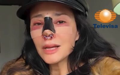 Actriz de Televisa reaparece tras cirugía fallida y revela avances en la reconstrucción de su nariz