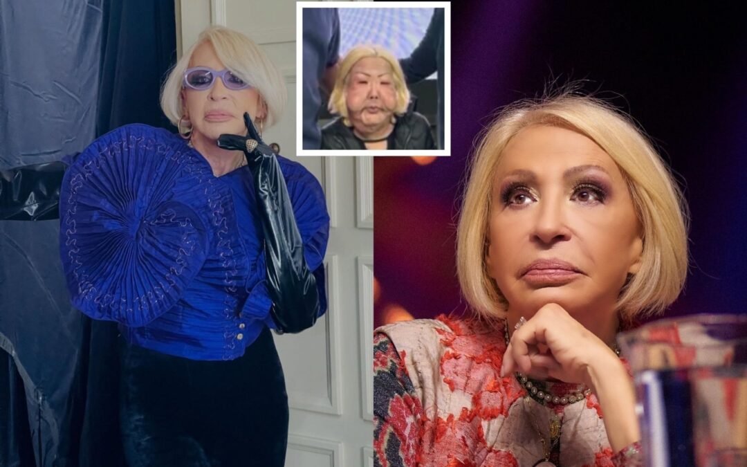¿Laura Bozzo quedó desfigurada tras cirugía? Esta es la verdad detrás del video viral