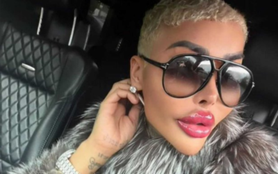 Muere Jordan James Parke tras cirugía estética para parecerse a Kim Kardashian