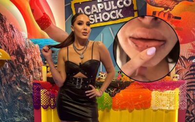 Isa Castro reaparece con el rostro golpeado y denuncia nueva agresión de su pareja