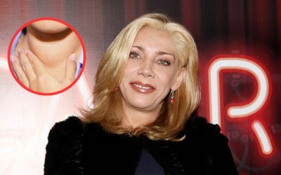 ¿Qué es Hashimoto, enfermedad incurable que padece Cynthia Klitbo?