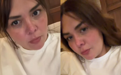 ¿Se quemó Yuridia? Revela extraña marca en su rostro | VIDEO