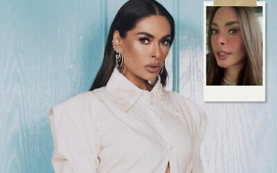 Galilea Montijo regresa a Hoy y confirma tratamiento que la dejó con el rostro irreconocible