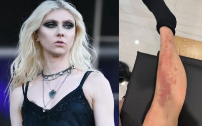 Hospitalizan a la cantante Taylor Momsen por picadura de araña