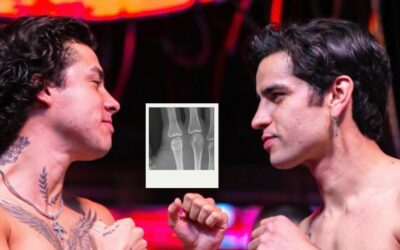 Mario Bautista sufre fractura tras nocaut ante Aarón Mercury en Supernova Génesis 2026