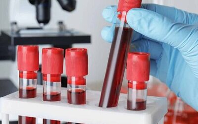 Caen los fallos por dopaje en ligas menores a sus mínimos