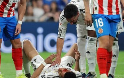 Kylian Mbappé regresa a los entrenamientos con un apósito en la ceja