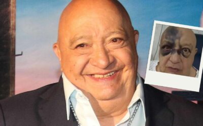 Comediante Luis de Alba preocupa tras fuerte golpe en el rostro; esto se sabe